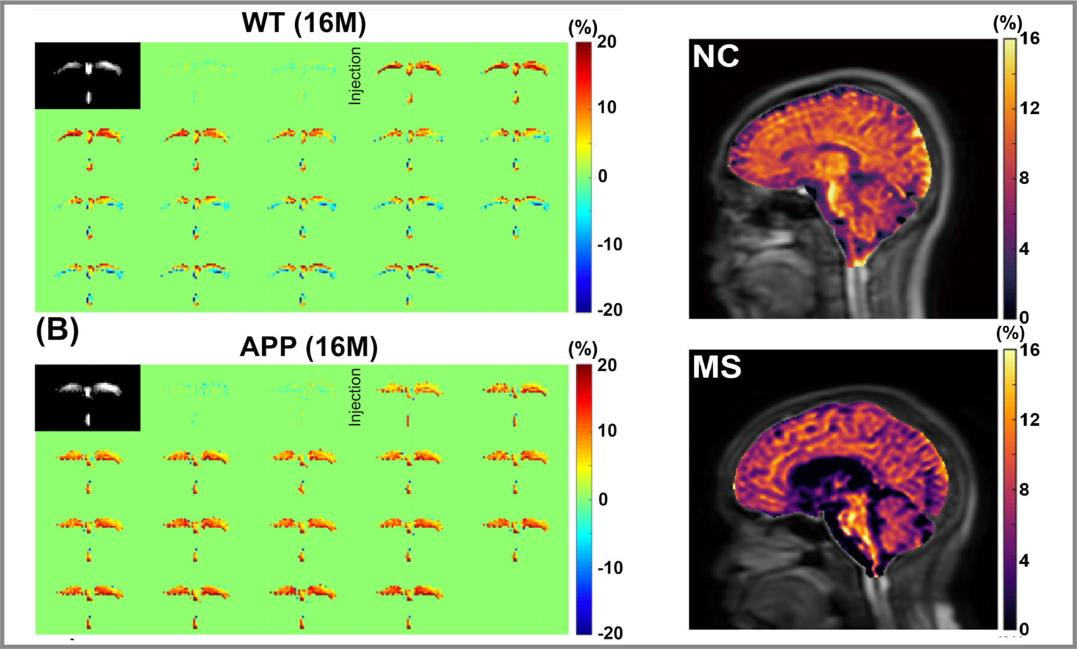 Imaging Biomarkers using CEST MRI for Neural Diseases