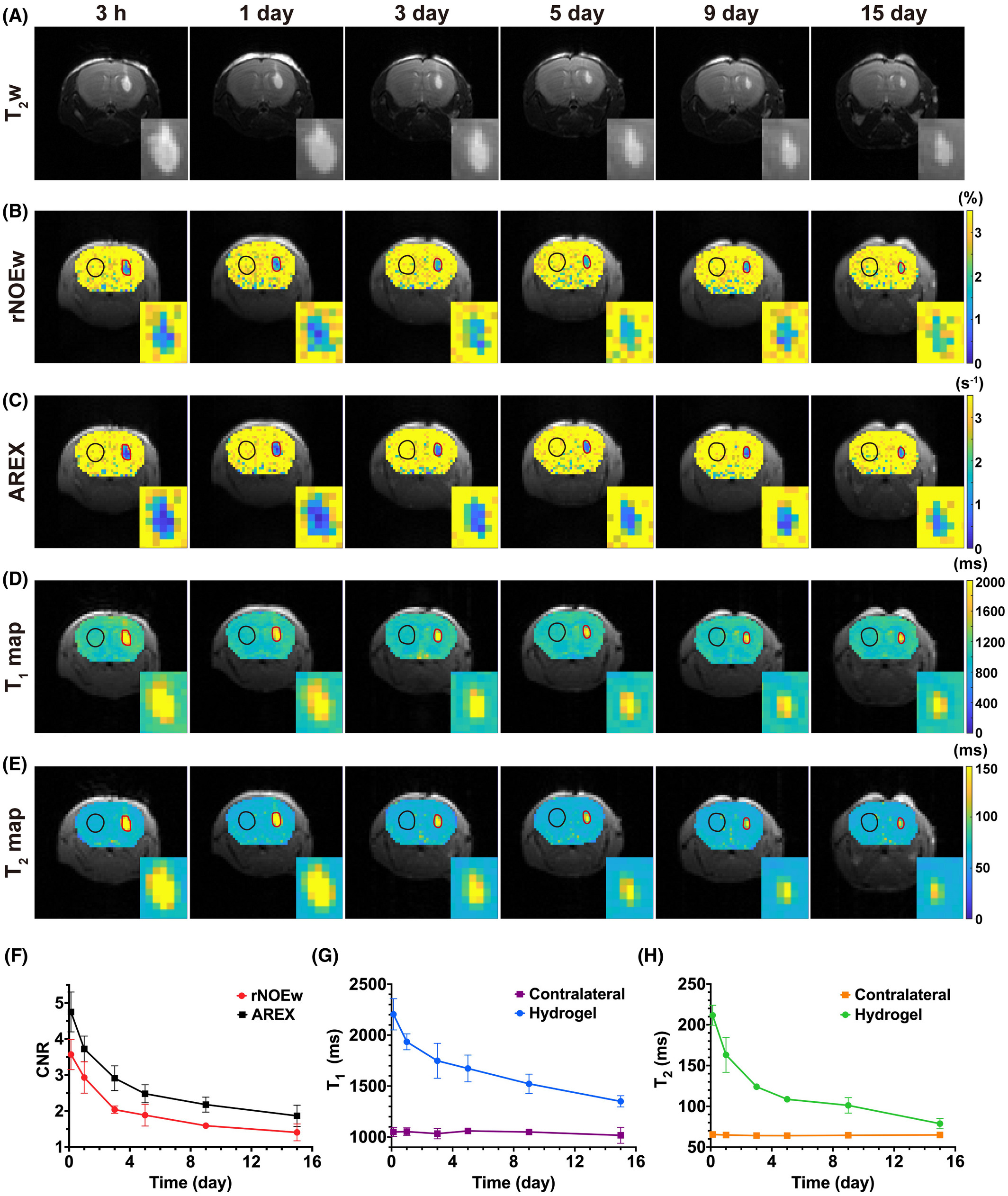 Relayed nuclear Overhauser enhancement imaging with magnetization transfer contrast suppression at 3 T