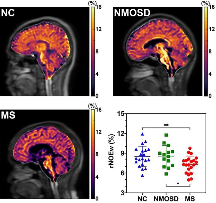 Relayed nuclear Overhauser effect weighted (rNOEw) imaging identifies multiple sclerosis