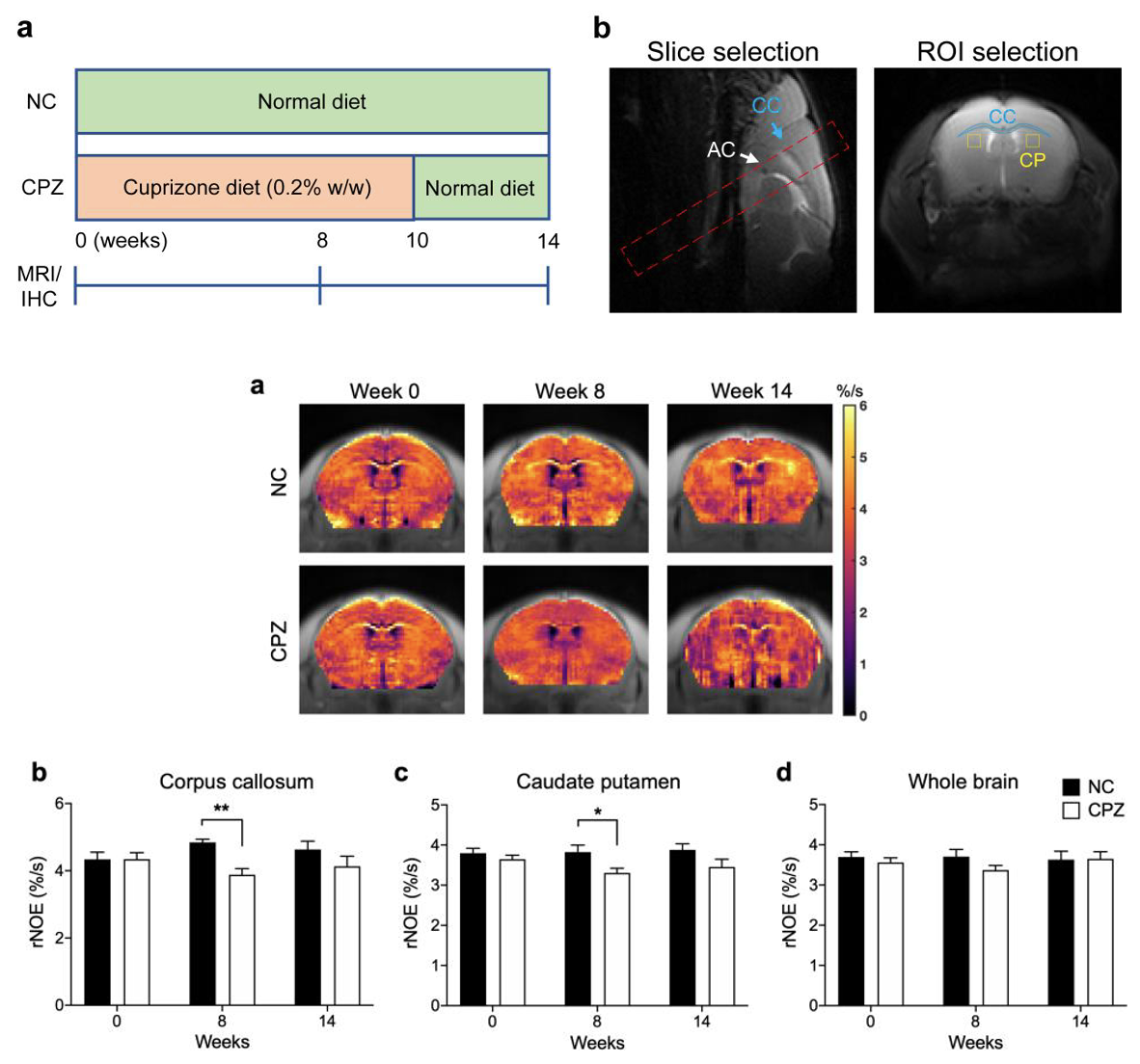 Chemical exchange saturation transfer (CEST) MRI detects myelin changes in cuprizone mouse model at 3T