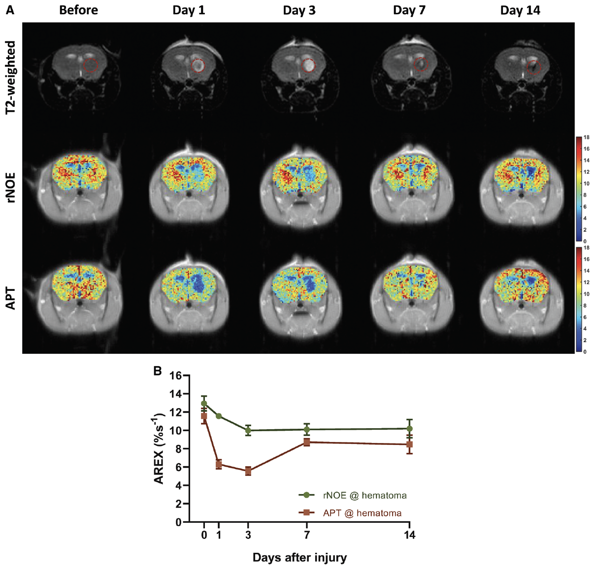 Chemical Exchange Saturation Transfer Magnetic Resonance Imaging for Longitudinal Assessment of Intracerebral Hemorrhage and Deferoxamine Treatment at 3T in a Mouse Model